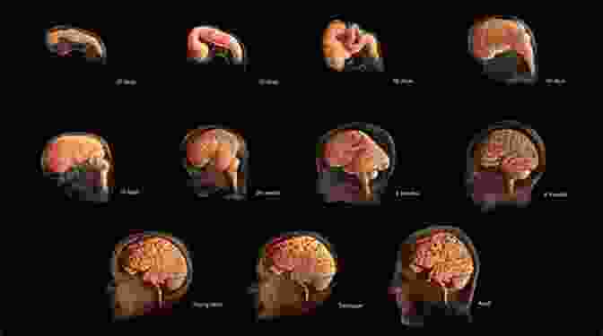 Image Of A Developing Brain Brain Development And Cognition: A Reader