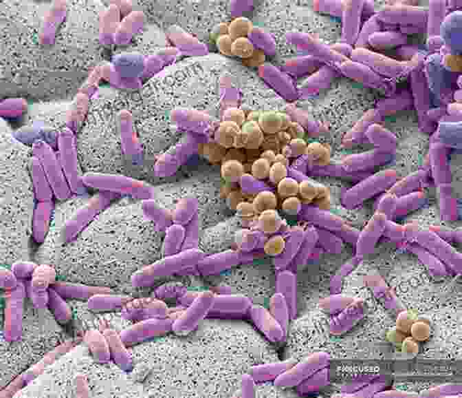 Microscopic View Of Bacteria Microbiology For Surgical Technologists Margaret Rodriguez