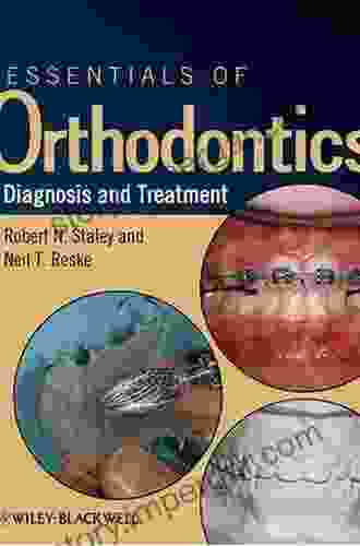 Essentials of Orthodontics: Diagnosis and Treatment