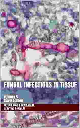 Fungal Infections in Tissue: Volume 5